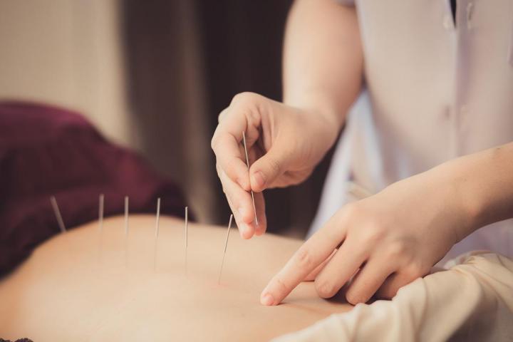 Acupuncture traditionnelle chinoise Argentan