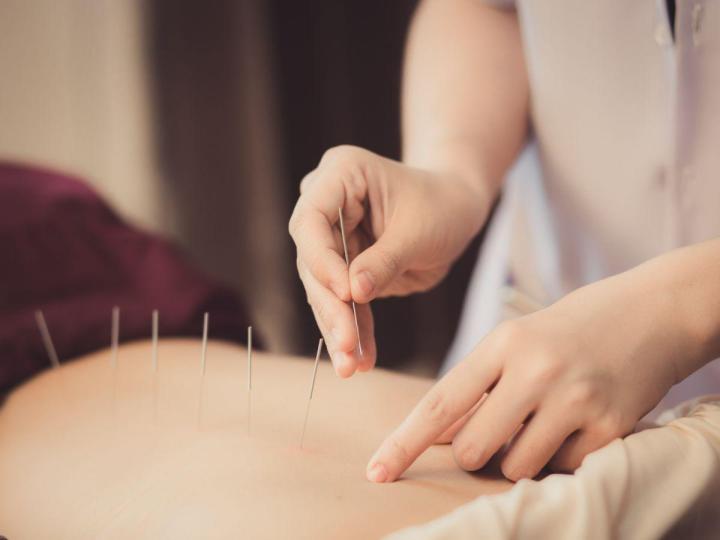 Praticien en acupuncture traditionnelle chinoise à Argentan